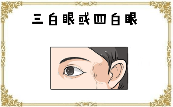 三白眼或四白眼