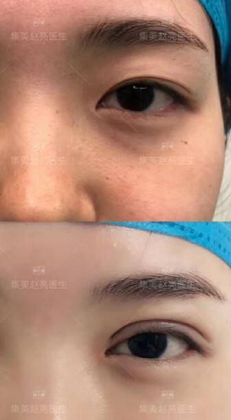 郑州整形排名_郑州元素酒窝整形图片(3)