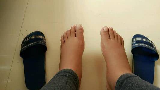 为什么老年人经常出现脚肿?总结:有2种原因,做好几点帮你远离