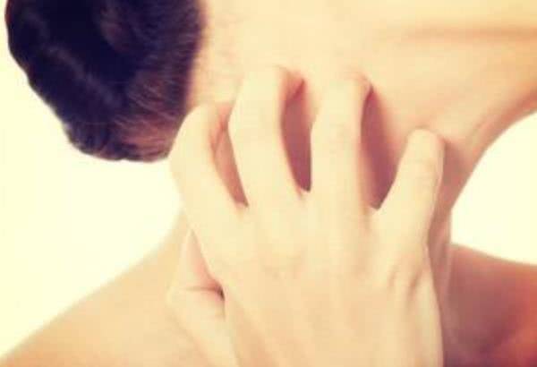 什么原因会引起湿疹的反复发作 7c32761bc8f344a68717035be3882e2e.jpeg