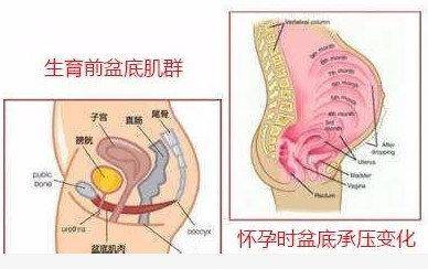 盆底肌决定女性是否健康的关键