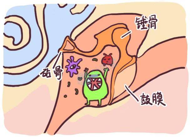 孩子中耳炎的发病率仅次于感冒,很多家长并不知道