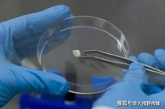 干细胞|爸爸妈妈们，可别再扔掉它越来越多父母为孩子储存乳牙