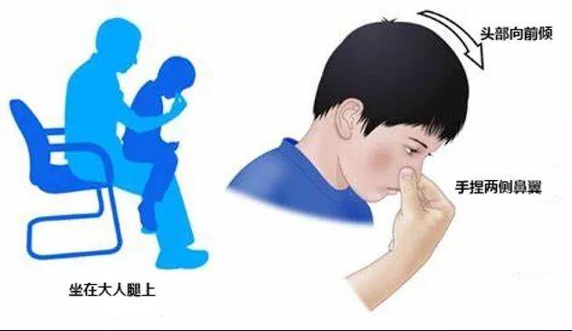 消化道|孩子消化道出血！这种“好东西”，千万别给孩子吃!一口“神仙水”