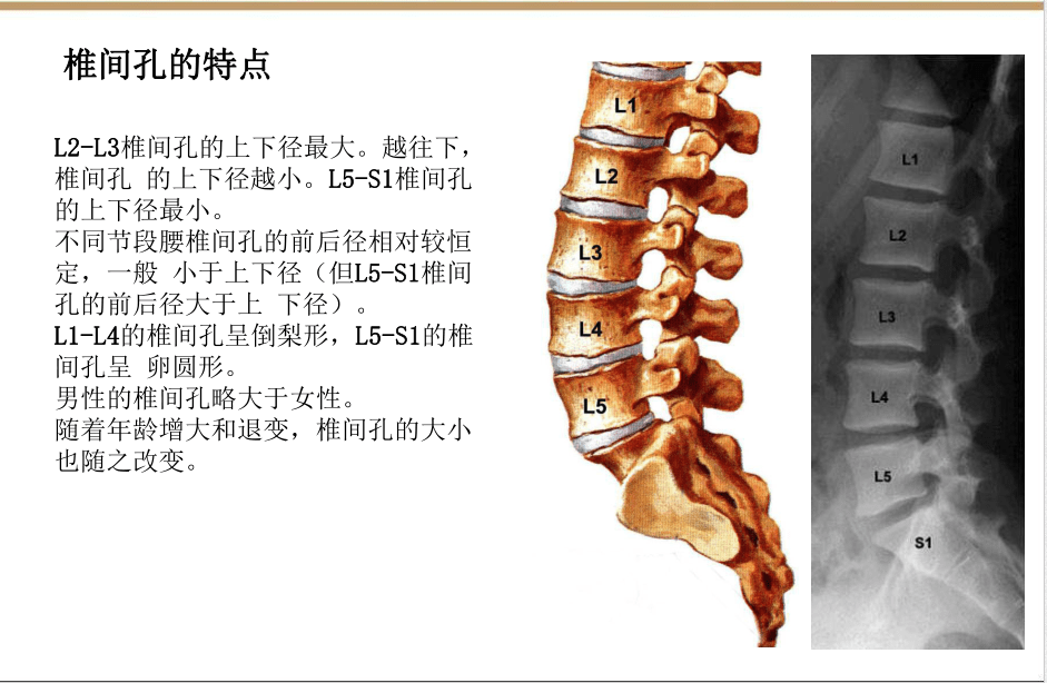 收藏版椎间孔镜技术脊柱应用解剖图表