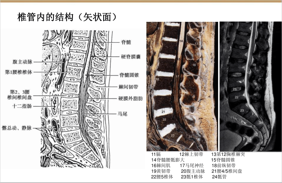 【收藏版】椎间孔镜技术脊柱应用解剖图表