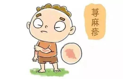 突发|多半是荨麻疹惹的祸!孩子身上突发红疙瘩