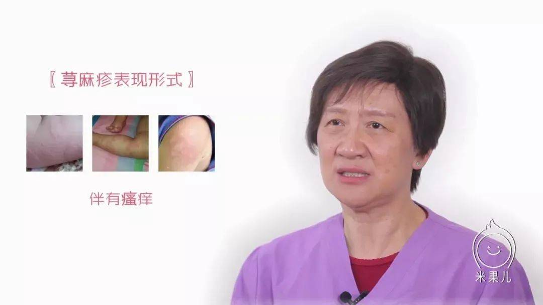突发|多半是荨麻疹惹的祸!孩子身上突发红疙瘩
