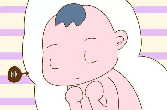 小宝宝|医生却说很好看，满月后见分晓新生儿因太“丑”遭全家嫌弃