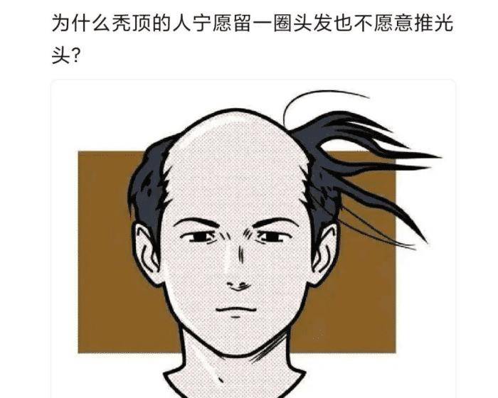 "为什么地中海的人宁愿留着剩下的头发,都不会选择剃掉?"哈哈