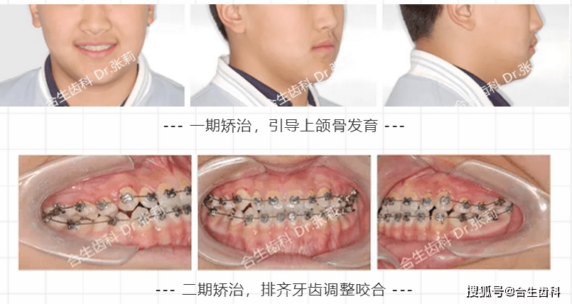 成人口齿不清如何矫正_如何纠正孩子口齿不清的问题(2)