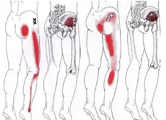 皮球怎么玩最简单 7c4535e34f7641189eeb54480fa7bccf.jpeg