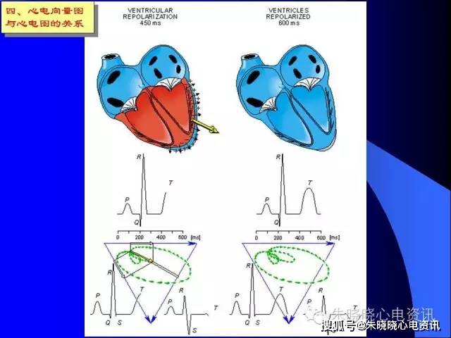 心电向量和心电图产生原理