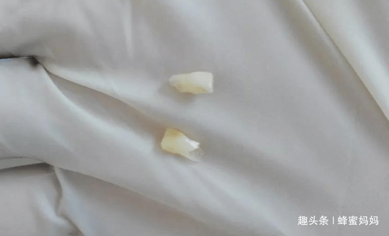 乳牙|重要时刻能“救命”？没这么简单宝宝“乳牙”掉了先别扔