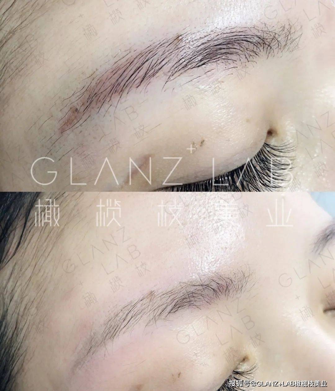 来了解下火爆市场的顶级黑科技无创洗眉技术吧|glanzxlab橄榄枝美业