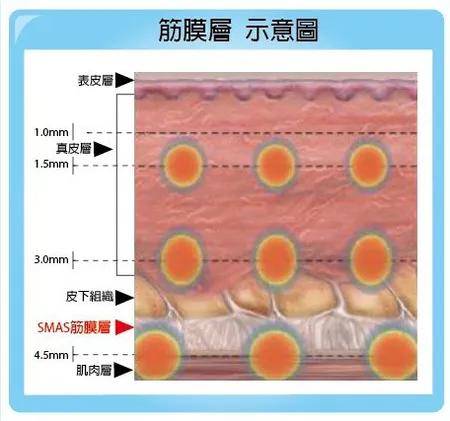 筋膜层,学名叫浅表肌腱系统,位于皮肤内部深约4.