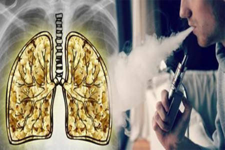 长时间吸食电子烟,易破破坏人体的免疫力,使得其肺部的细胞失效病