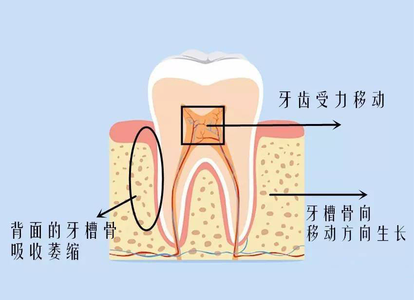 挽救牙槽骨根基的最好方法!