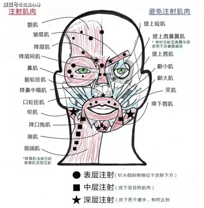 打瘦脸针失败怎么办