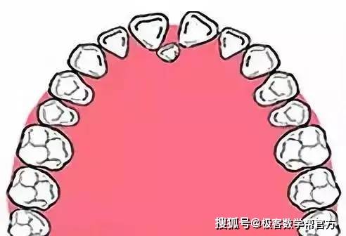 牙齿|家长请注意：孩子12岁前必须矫治的几种牙齿畸形