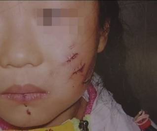 随处可见却容易被忽视的幼儿安全杀手！防患于未然才不会悔之莫及！