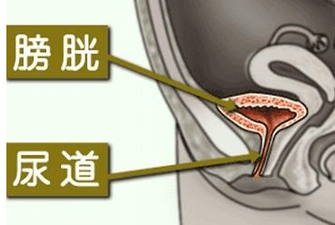 【必看】克芮哆:如何分辨自己得了膀胱炎