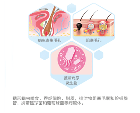 dfc2052e59914028a4adecb989c1635a.png