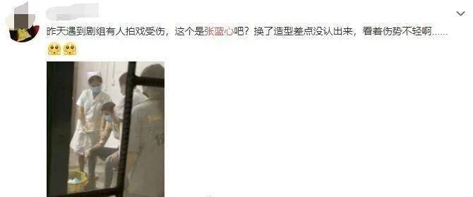 受伤|张蓝心拍戏头部受伤，头裹纱布满身血迹，为赶进度拒绝缝针