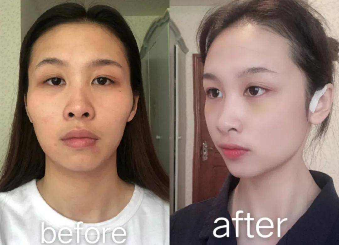 高圆圆|高圆圆整前生图曝光，惊到我了，do的一点不比baby少！