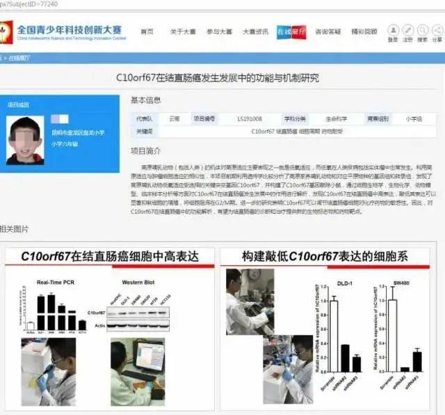 什么时候才能攻克癌症啊 3b84ae9ff6294f63af9cfba6378a2c89.jpeg