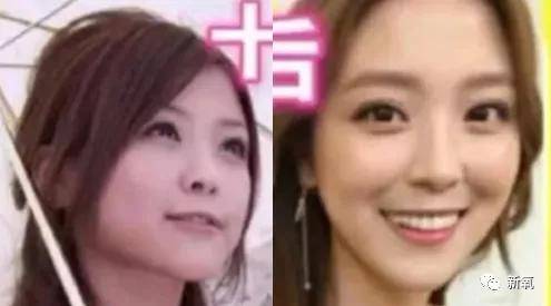 张脸|当年艳绝四方让张雨绮都甘心做配,可现在这张脸说崩就崩了...