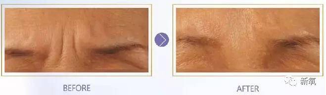 张脸|当年艳绝四方让张雨绮都甘心做配,可现在这张脸说崩就崩了...