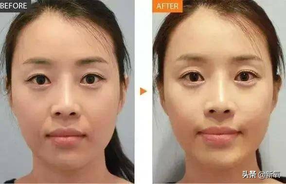 区花|杨紫青簪行被嘲照骗，生图剧照判若两人，她的修图师太难了！