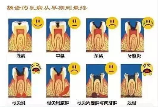 炎,出现咬合时明显的疼痛,并且在刚感染侧的牙龈或脸颊出现明显的肿胀