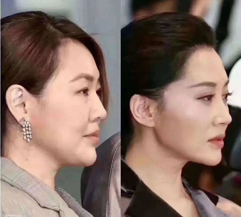 双腿|学会这套瑜伽体式，提升气质改善气色，40岁也能拥有20岁的脸