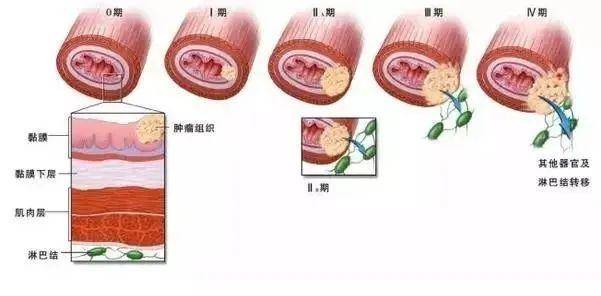 9f95fb4bb91a43a58c2339a1a6e94f6b.jpeg