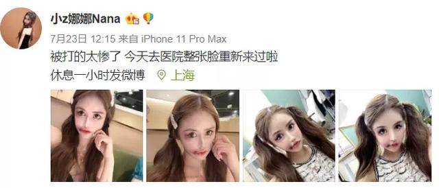 娜娜|05后网红整残自己？自曝13岁开始整容，3年整容100次，花费超百万