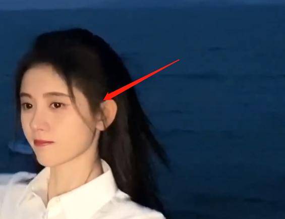 慎入|鞠婧祎再次暴露真实发量，痕迹明显密集恐惧症患者慎入