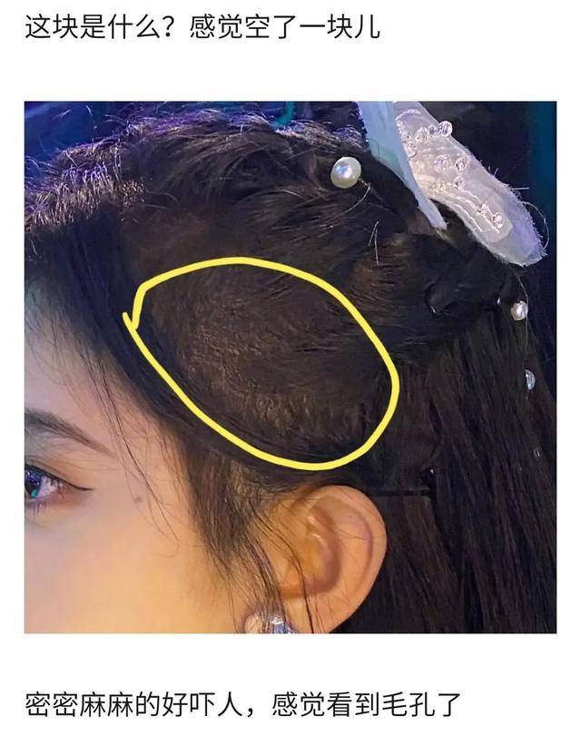 慎入|鞠婧祎再次暴露真实发量，痕迹明显密集恐惧症患者慎入