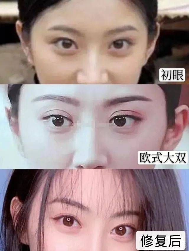 双眼皮|景甜整容整成了“悲伤蛙”，还有比这更悲伤的吗？