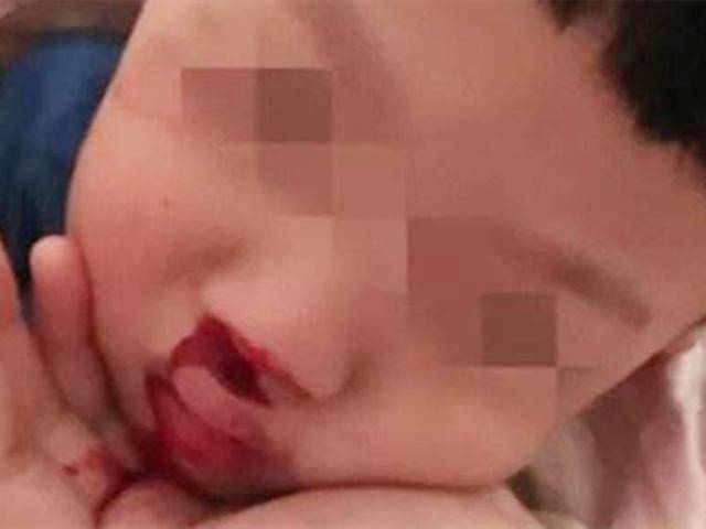 孩子|送医后被告知“无法救治”，只因宝妈这一错误做法3岁娃流鼻血