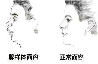 宝宝|这样做减轻孩子痛苦孩子睡觉有这个表现一定要注意！严重会影响智力发育