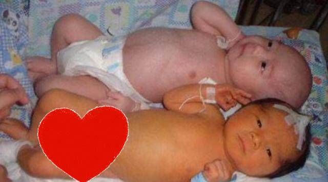 宝宝|丈夫怀疑不是亲生，原来是孕期吃了这几样东西双胞胎“奥利奥”