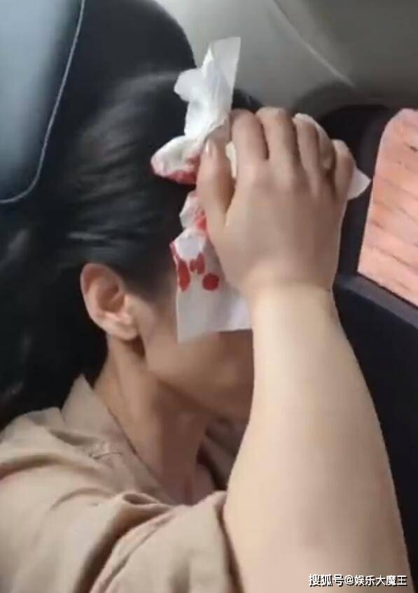 乘风破浪又一位姐姐出事！黄圣依拍戏被砸伤，