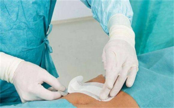 怎么护理剖腹产的产妇 5d335d9730764e2cb33510ceeb4ab9df.jpeg