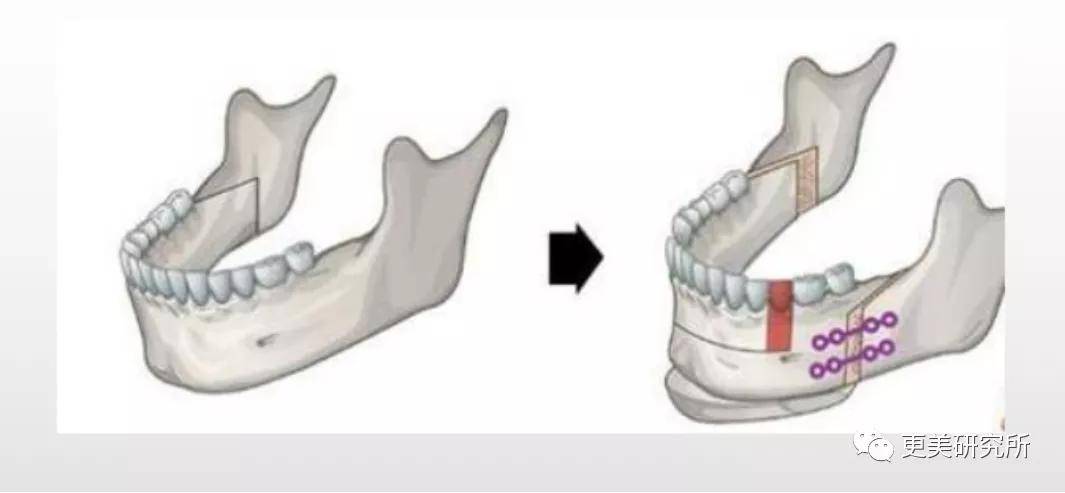 伸缩|蔡徐坤的下巴会自动伸缩？！这是do脸实锤了？