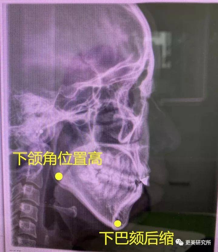 伸缩|蔡徐坤的下巴会自动伸缩？！这是do脸实锤了？