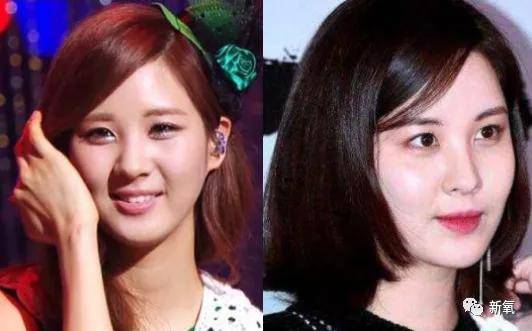 徐贤|从小土妹逆袭成神颜财阀公主，这位爱豆的换头思路请反复朗诵800遍！