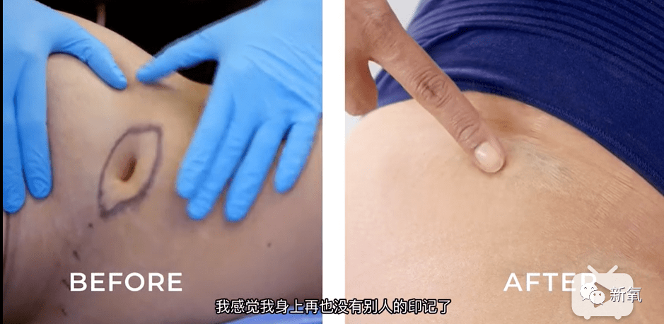 公敌|刘诗诗最新生图流出，生完孩子这张脸，真女明星公敌！！