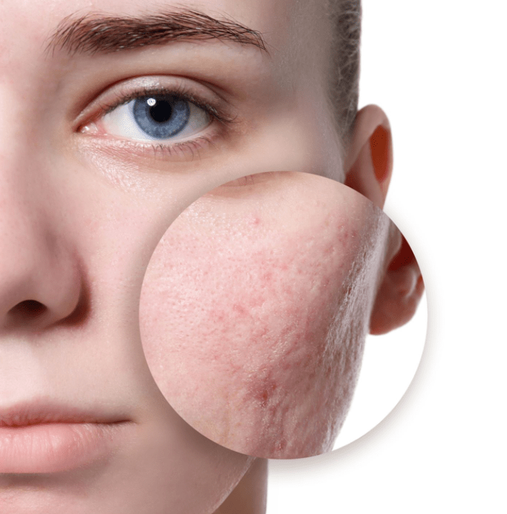 姐妹|直播卸妆想要证明自己是素颜美人,却因太敷衍被嘲假鼻子假脸碰不得?